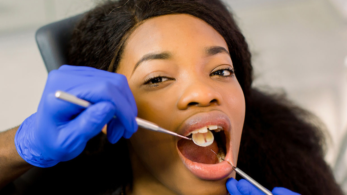 CALCULUS/STAIN REMOVAL